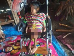 Kisah Ika Salsabila, Gadis Lumpuh Asal Grobogan yang Tak Pernah Tersentuh Bantuan Pemerintah