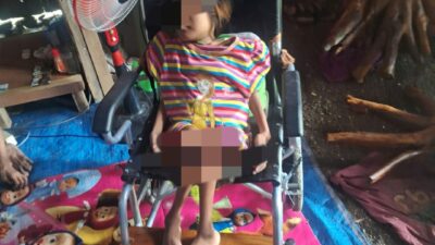 Ika Salsabila, kesehariannya dihabiskan duduk di atas kursi roda, Selasa (12/3/2024). (Masrikin/kabarterdepan.com)