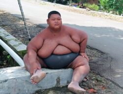 Kisah Pria Obesitas di Sragen, Sehari Makan Hingga 8 Kali