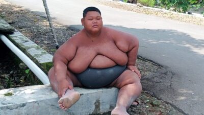 Sungadi (25), pria obesitas asal Sragen. (Masrikin/kabarterdepan.com)