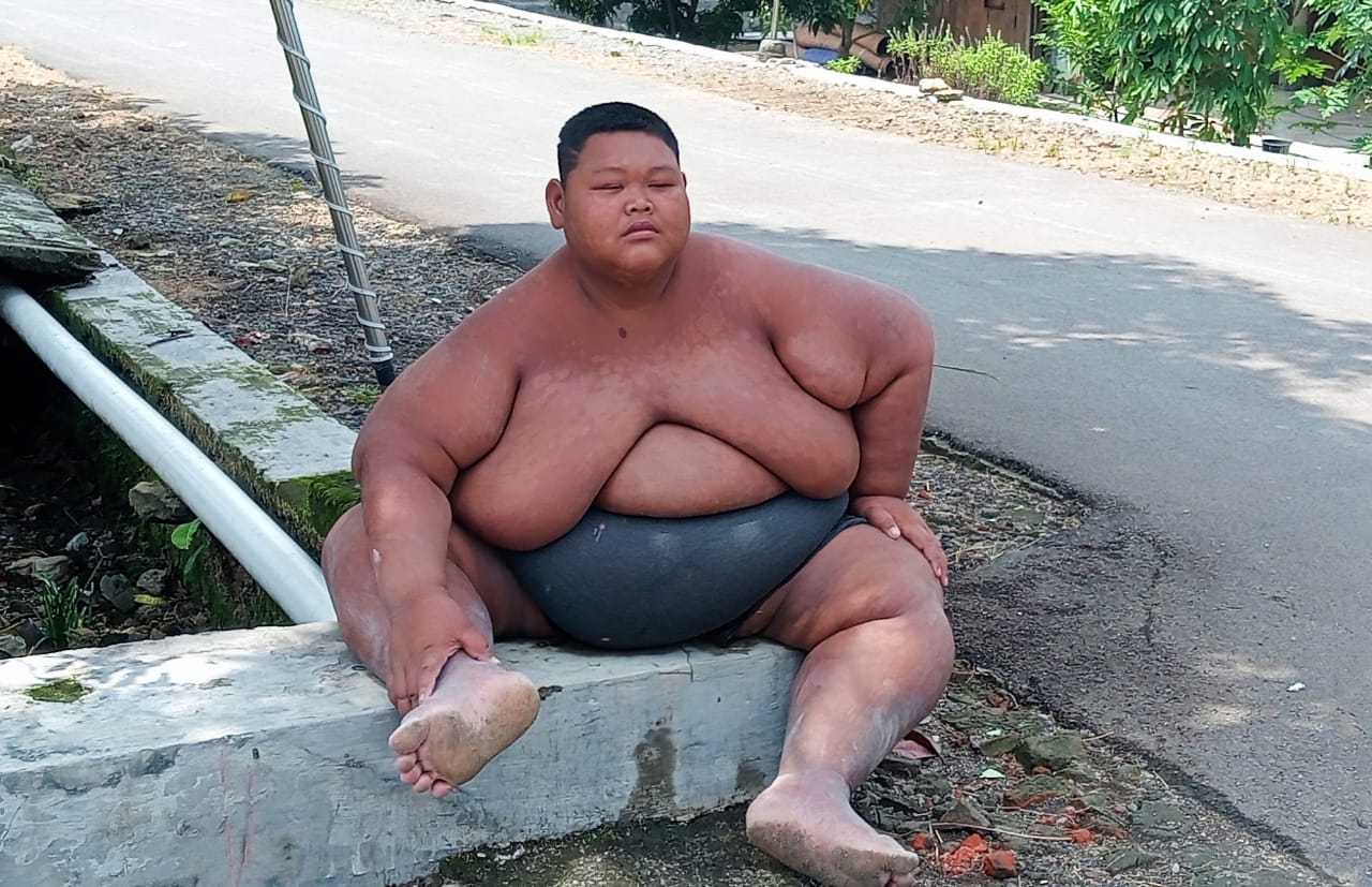 Sungadi (25), pria obesitas asal Sragen. (Masrikin/kabarterdepan.com) 