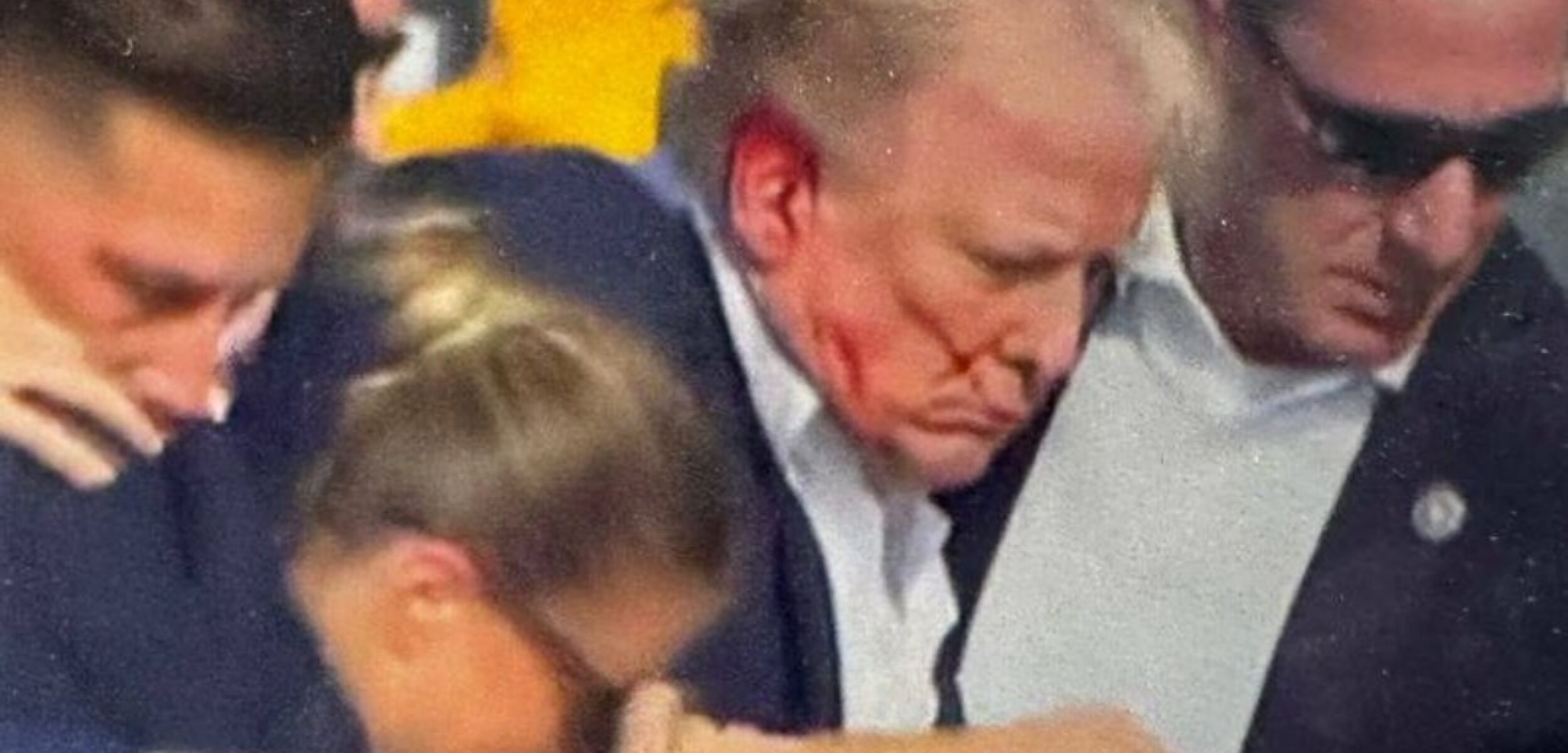 Telinga Donald Trump yang berdarah usia insiden penembakan saat kampanye, Minggu (14/7/2024). (X @blaire Withe)