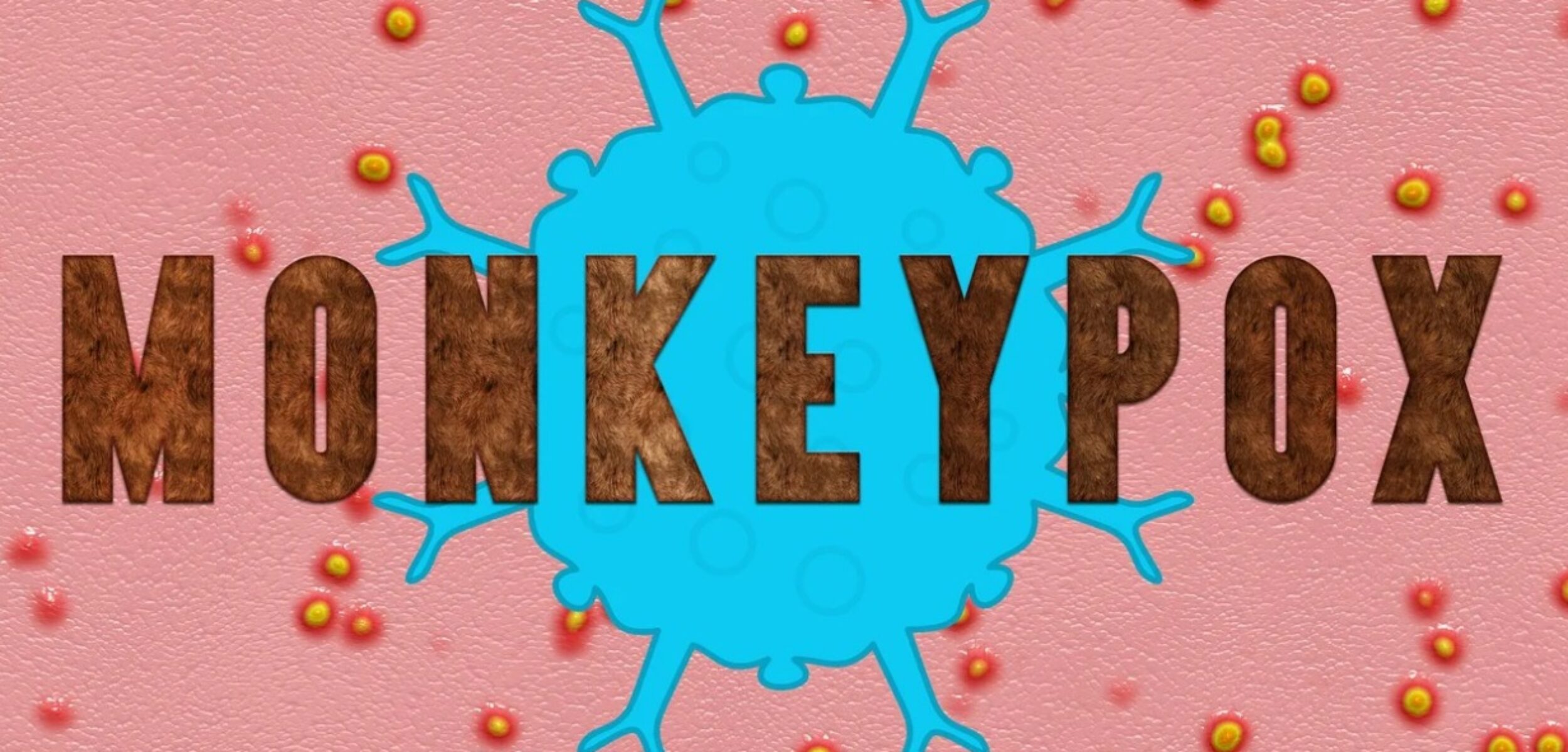 Cegah Mpox, Konsumsi 5 Makanan dan Minuman Ini untuk Bantu Tingkatkan Imun Tubuh