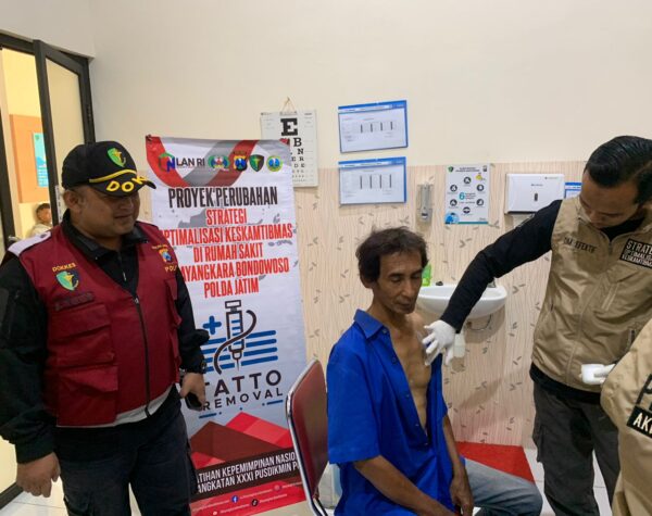 Program Hapus Tato Gratis dari Polresta Banyuwangi Tuai Respon Positif