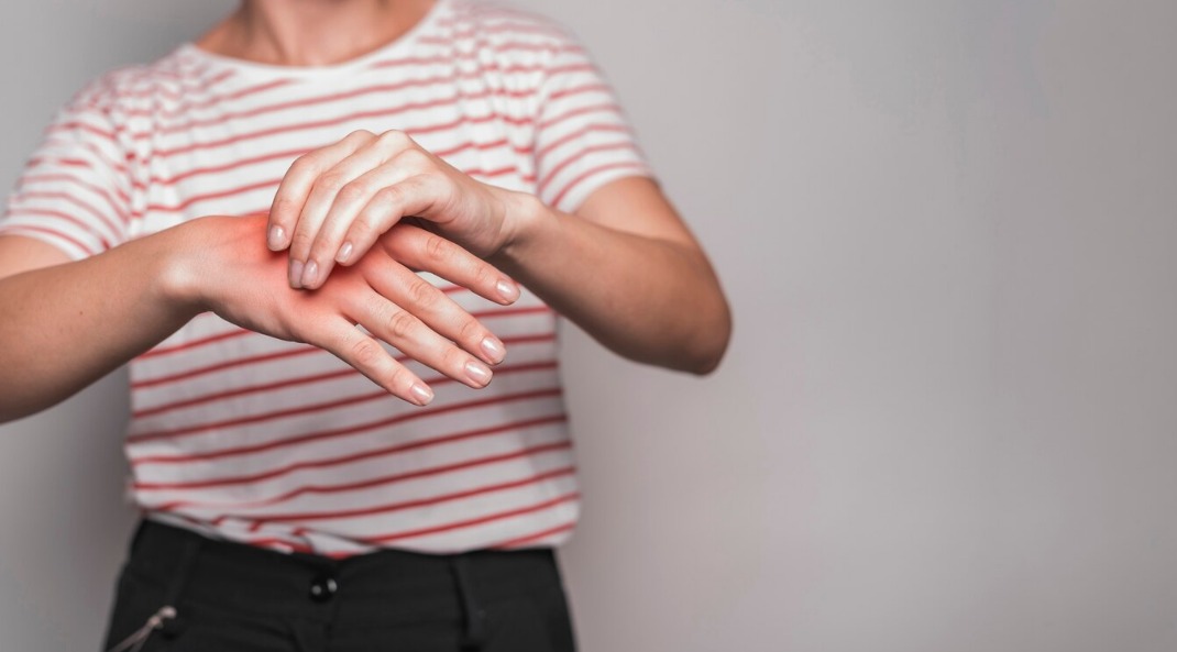 Catat! Ini 5 Penyebab Asam Urat di Usia Muda