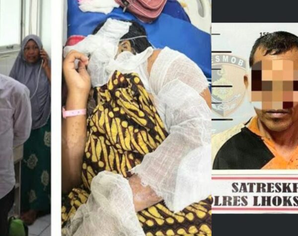 Kekerasan di Aceh Utara, Pria Siram Dua Anak Tirinya dengan Air Keras. Satu Tewas, Satu Luka Parah