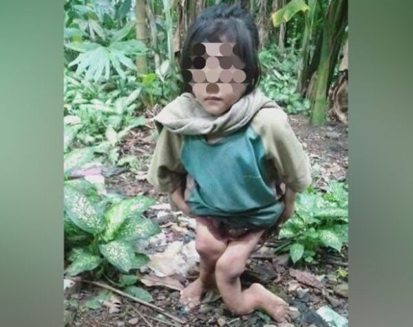 Tragis Penganiayaan Bocah 10 Tahun, Tidur di Kandang Ayam Kondisi Kaki Patah