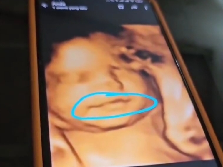 SmartSelect 20250510 210110 Instagram