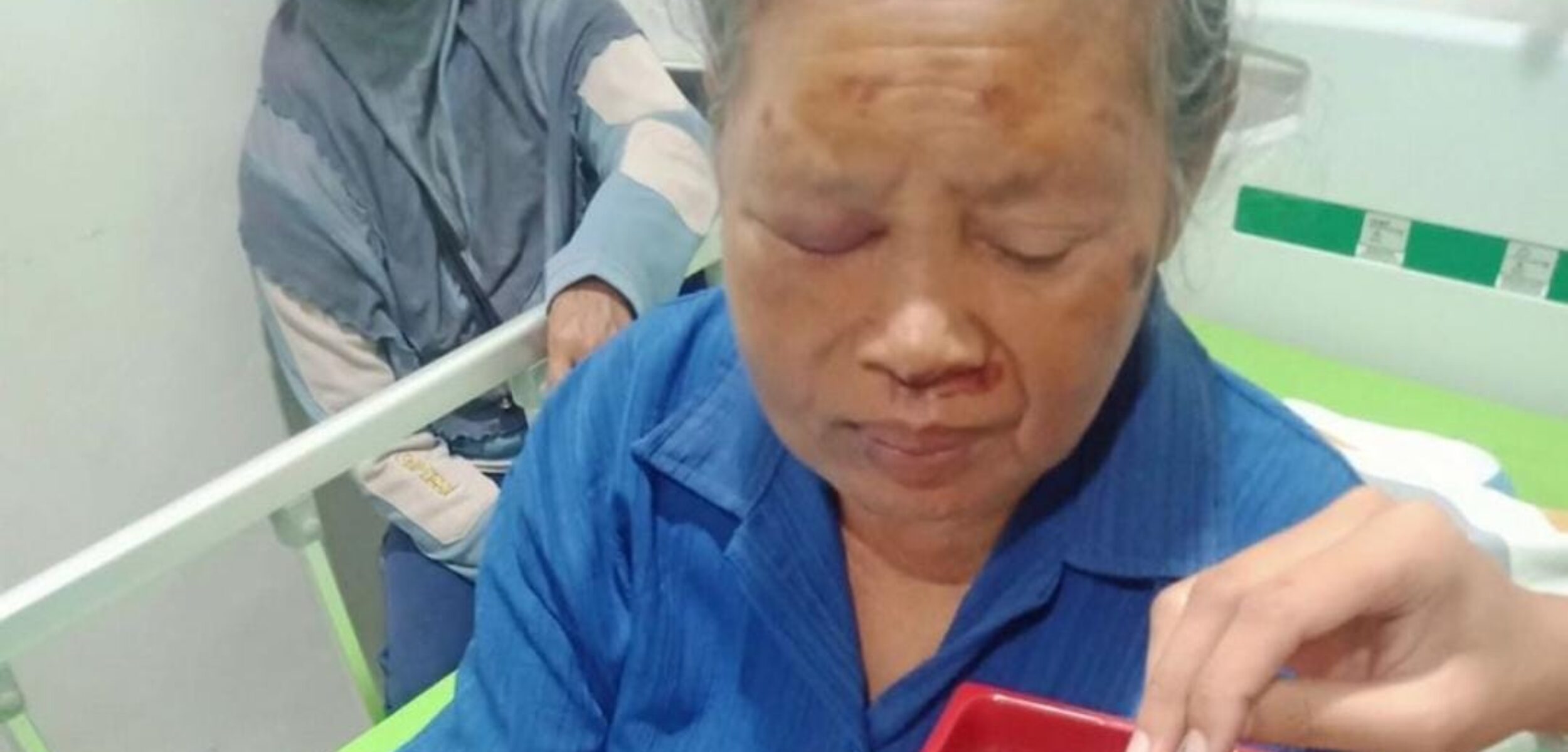 Seorang Wanita Tua Jadi Korban Tabrak Lari di Paseban Bantul