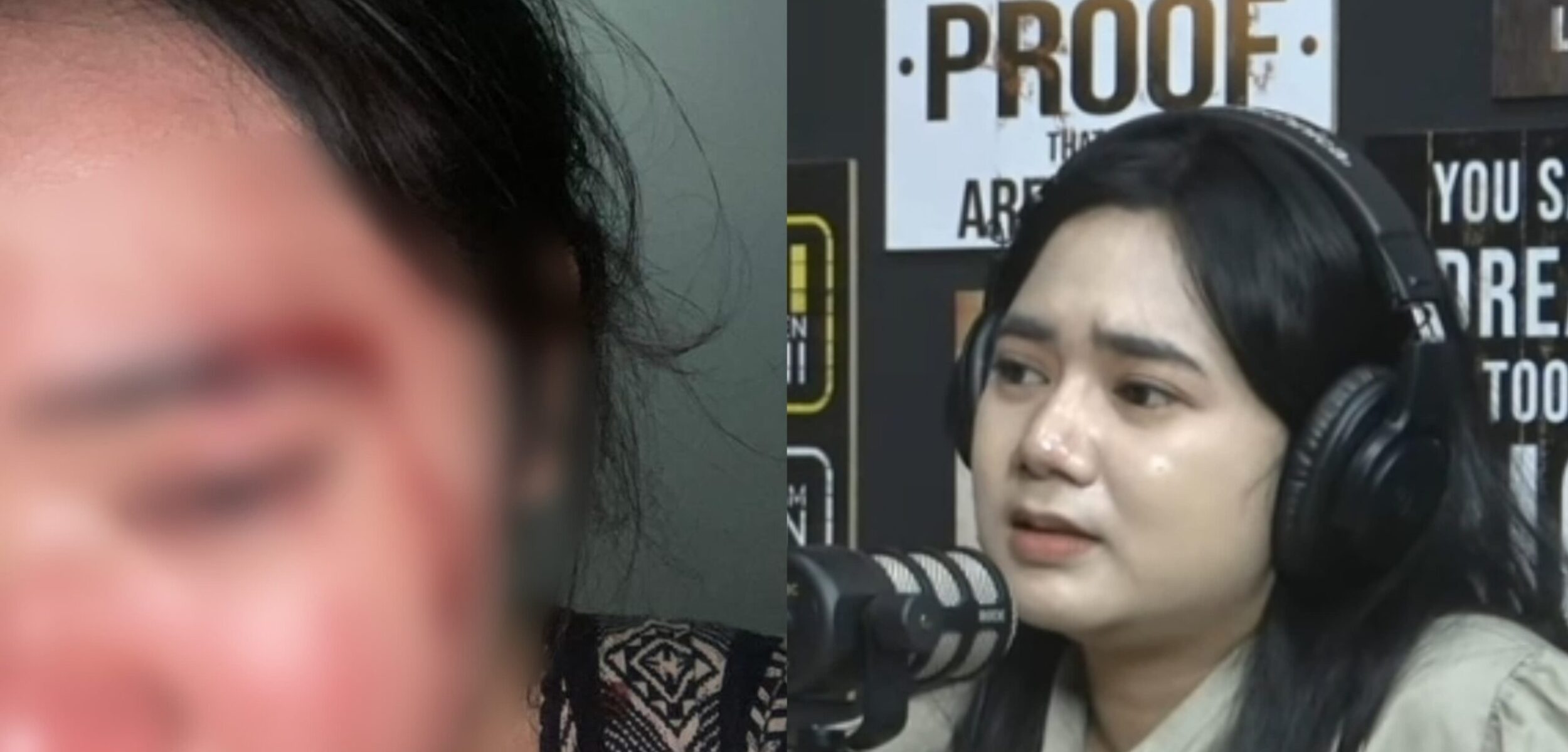 Laporkan Suami ke Polisi, Istri Asal Jombang Buka Suara Alami KDRT hingga Dipukuli Saat Hamil