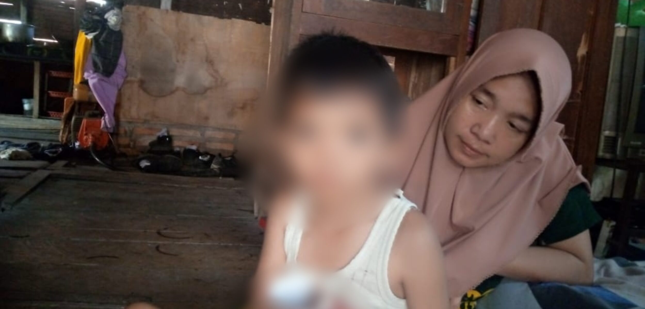 Potret Rahmad, bocah berusia 7 tahun asal Mandailing Natal yang lahir dengan kecacatan tubuh dan tanpa anus. (Suhartono / Kabarterdepan.com)
