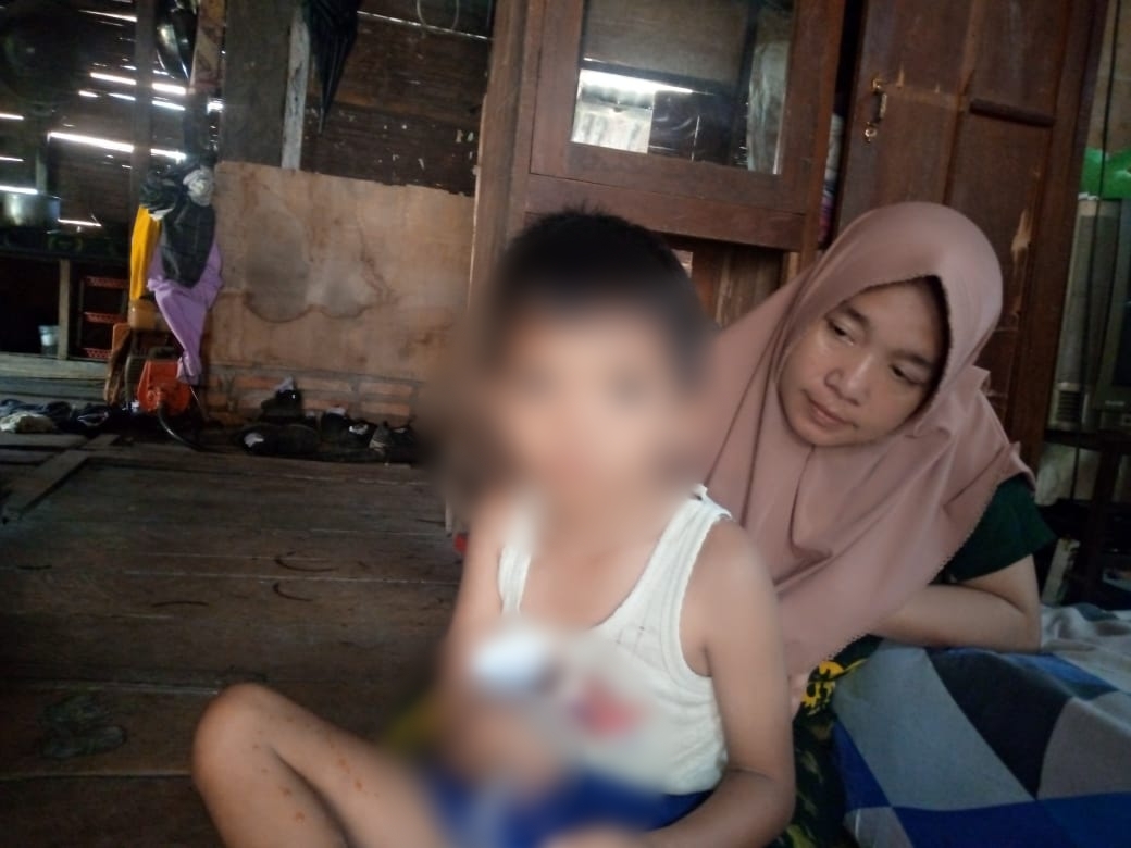 MEITU 20251009 202452621 1 Potret Rahmad, bocah berusia 7 tahun asal Mandailing Natal yang lahir dengan kecacatan tubuh dan tanpa anus. (Suhartono / Kabarterdepan.com)