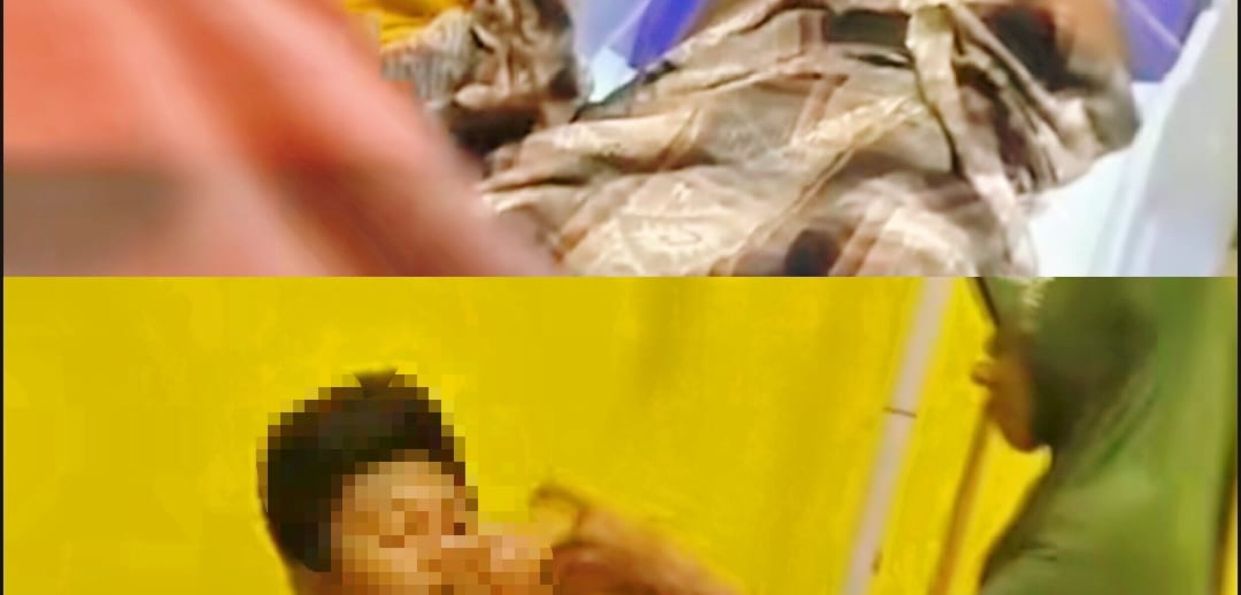 Petasan Kaleng Susu Meledak, 2 Korban Luka Bakar